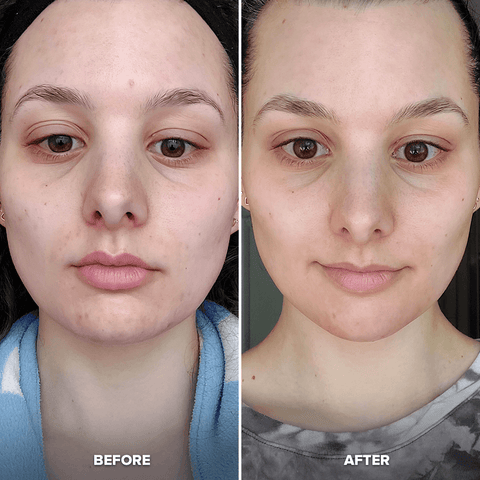 Glow & Go Bundle Glow & Go Bundle