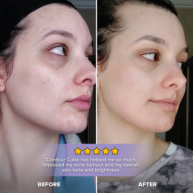 Pink Contour Cube&reg; Starter Pack