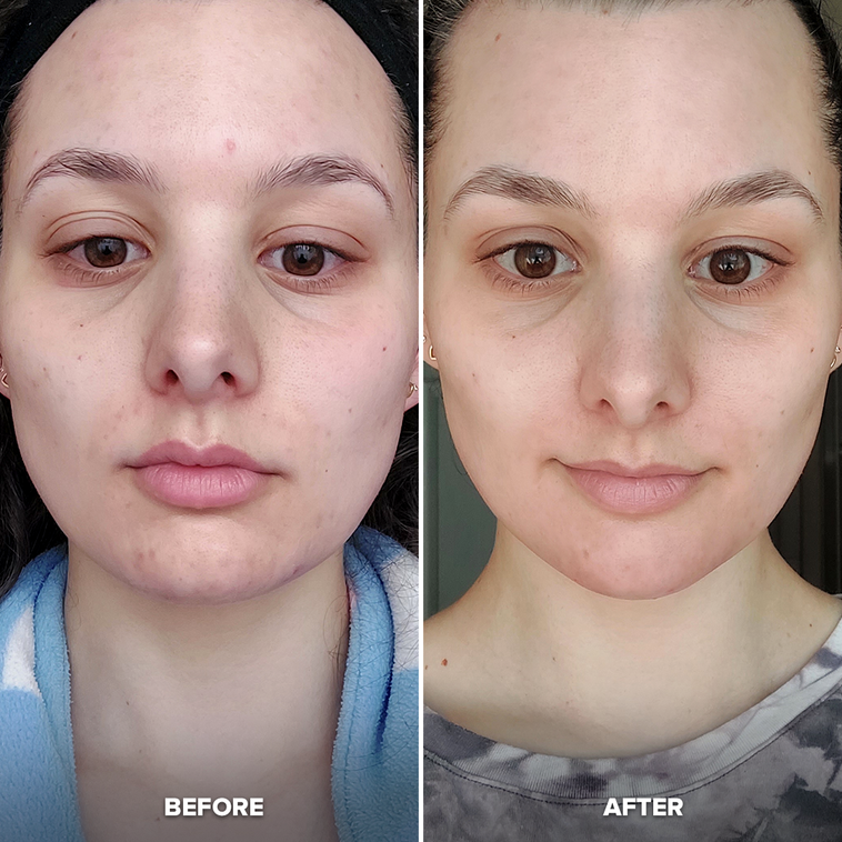 Pink Contour Cube&reg; Starter Pack